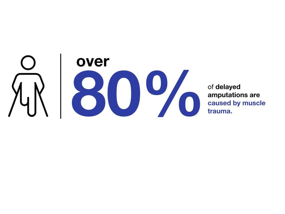 Over 250,000 traumatic muscle injuries a year