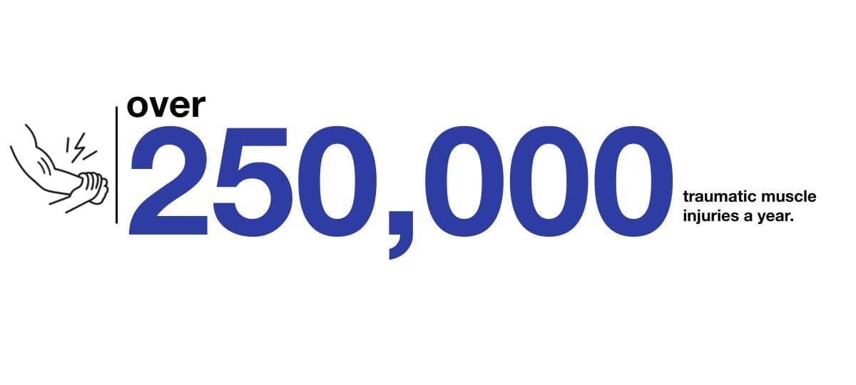 90% of muscle conditions in medically retired, battlefield-injured Service Members are due to VML