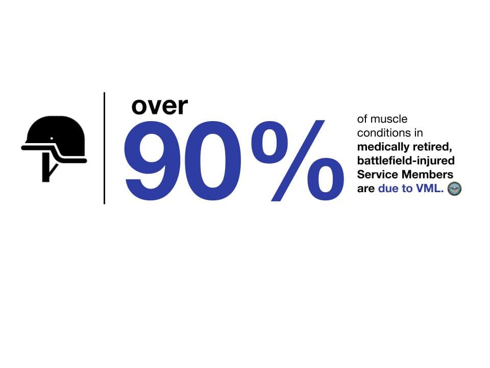 Over 80% of delayed amputations are caused by muscle trauma